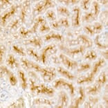 Immunohistochemistry - Anti-TGF beta Receptor II Antibody [ARC57218] (A309003) - Antibodies.com