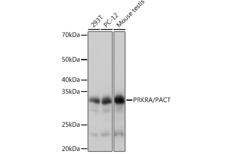 Western Blot - Anti-PACT (phospho KR activating protein)/PRKRA Antibody [ARC1299] (A309004) - Antibodies.com