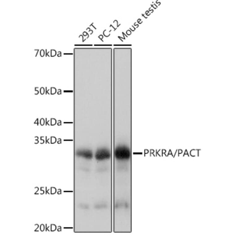Western Blot - Anti-PACT (phospho KR activating protein)/PRKRA Antibody [ARC1299] (A309004) - Antibodies.com