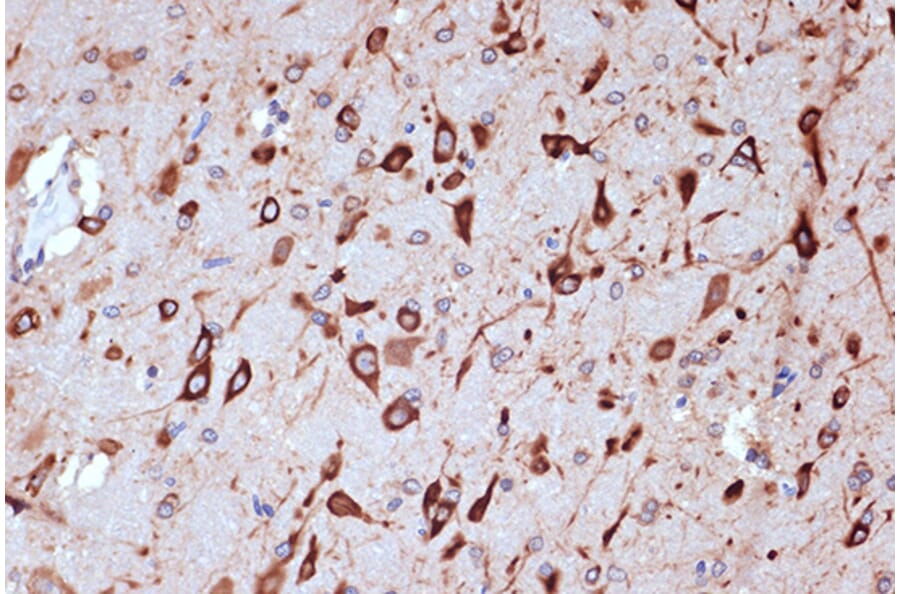 Immunohistochemistry - Anti-PACT (phospho KR activating protein)/PRKRA Antibody [ARC1299] (A309004) - Antibodies.com