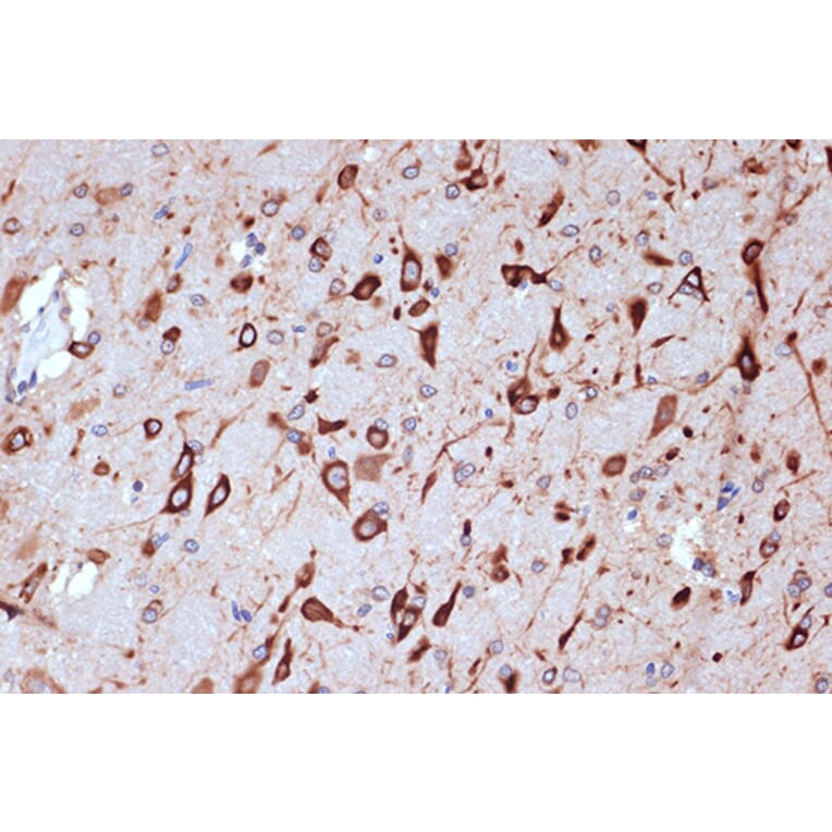 Immunohistochemistry - Anti-PACT (phospho KR activating protein)/PRKRA Antibody [ARC1299] (A309004) - Antibodies.com