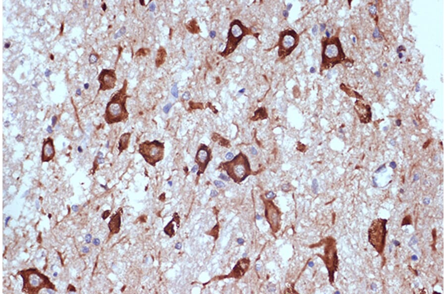Immunohistochemistry - Anti-PACT (phospho KR activating protein)/PRKRA Antibody [ARC1299] (A309004) - Antibodies.com