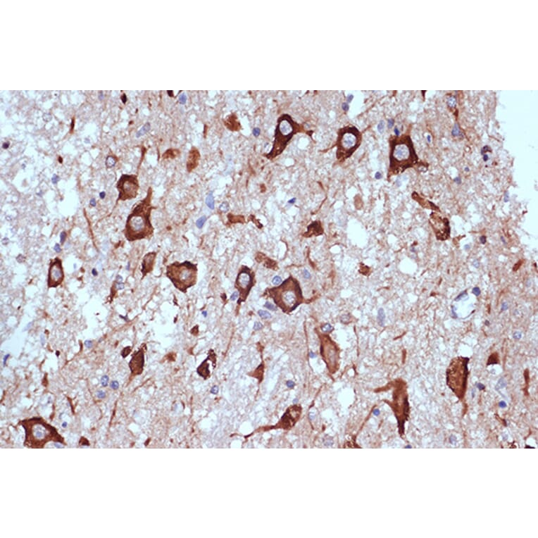 Immunohistochemistry - Anti-PACT (phospho KR activating protein)/PRKRA Antibody [ARC1299] (A309004) - Antibodies.com