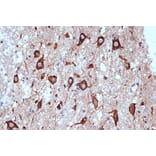 Immunohistochemistry - Anti-PACT (phospho KR activating protein)/PRKRA Antibody [ARC1299] (A309004) - Antibodies.com
