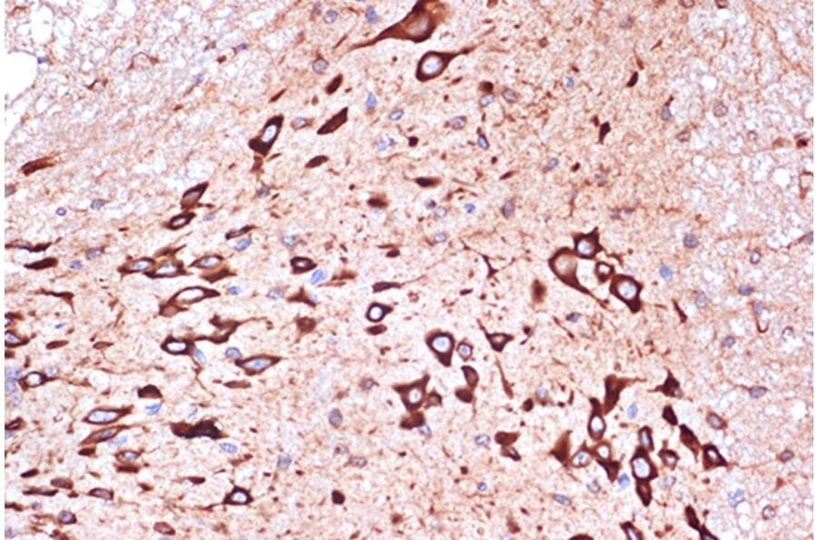 Immunohistochemistry - Anti-PACT (phospho KR activating protein)/PRKRA Antibody [ARC1299] (A309004) - Antibodies.com