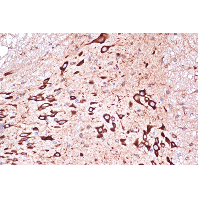 Immunohistochemistry - Anti-PACT (phospho KR activating protein)/PRKRA Antibody [ARC1299] (A309004) - Antibodies.com