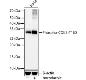 Western Blot - Anti-CDK2 (phospho Thr160) Antibody [ARC57167] (A309005) - Antibodies.com
