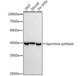 Western Blot - Anti-Spermine synthase Antibody [ARC2747] (A309006) - Antibodies.com