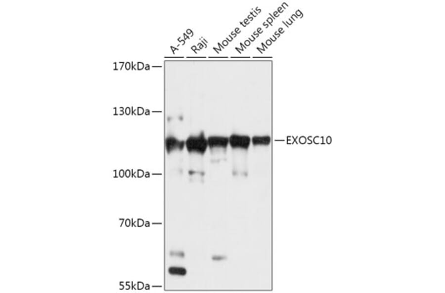 Western Blot - Anti-EXOSC10/RRP6 Antibody (A309007) - Antibodies.com