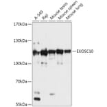 Western Blot - Anti-EXOSC10/RRP6 Antibody (A309007) - Antibodies.com