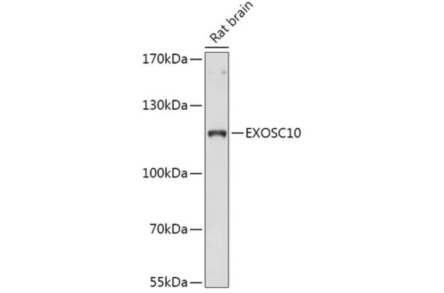 Western Blot - Anti-EXOSC10/RRP6 Antibody (A309007) - Antibodies.com