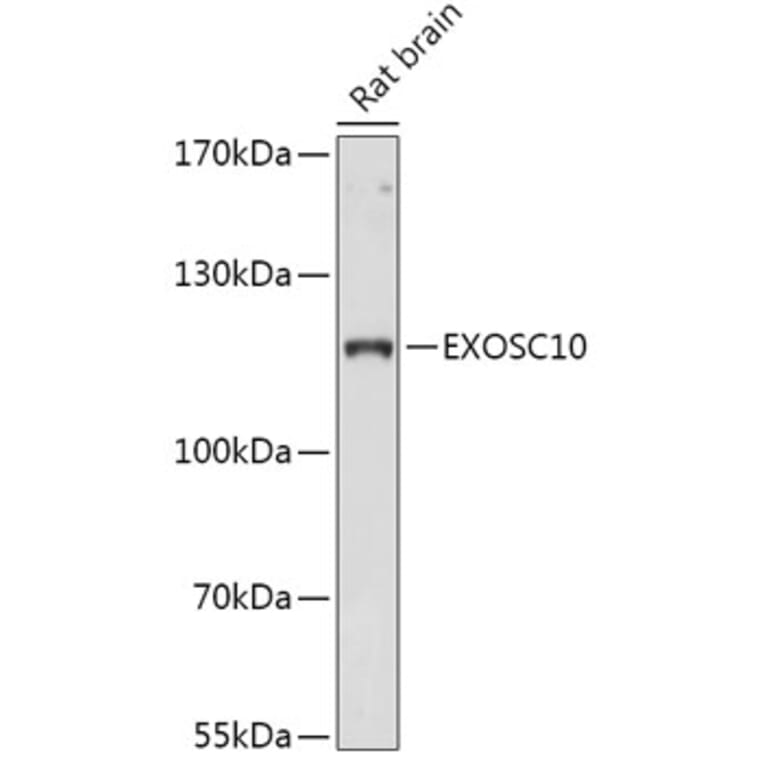 Western Blot - Anti-EXOSC10/RRP6 Antibody (A309007) - Antibodies.com