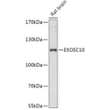 Western Blot - Anti-EXOSC10/RRP6 Antibody (A309007) - Antibodies.com