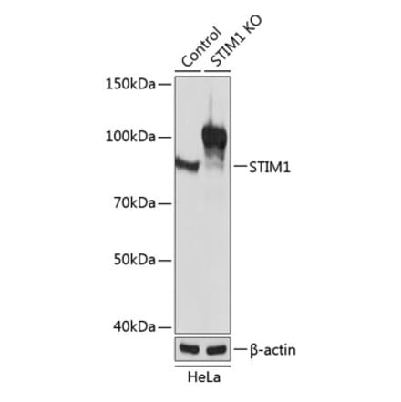 Western Blot - Anti-Stromal interaction molecule 1 Antibody (A309008) - Antibodies.com