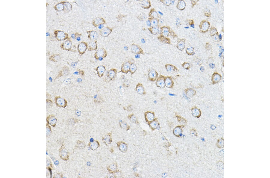 Immunohistochemistry - Anti-Stromal interaction molecule 1 Antibody (A309009) - Antibodies.com