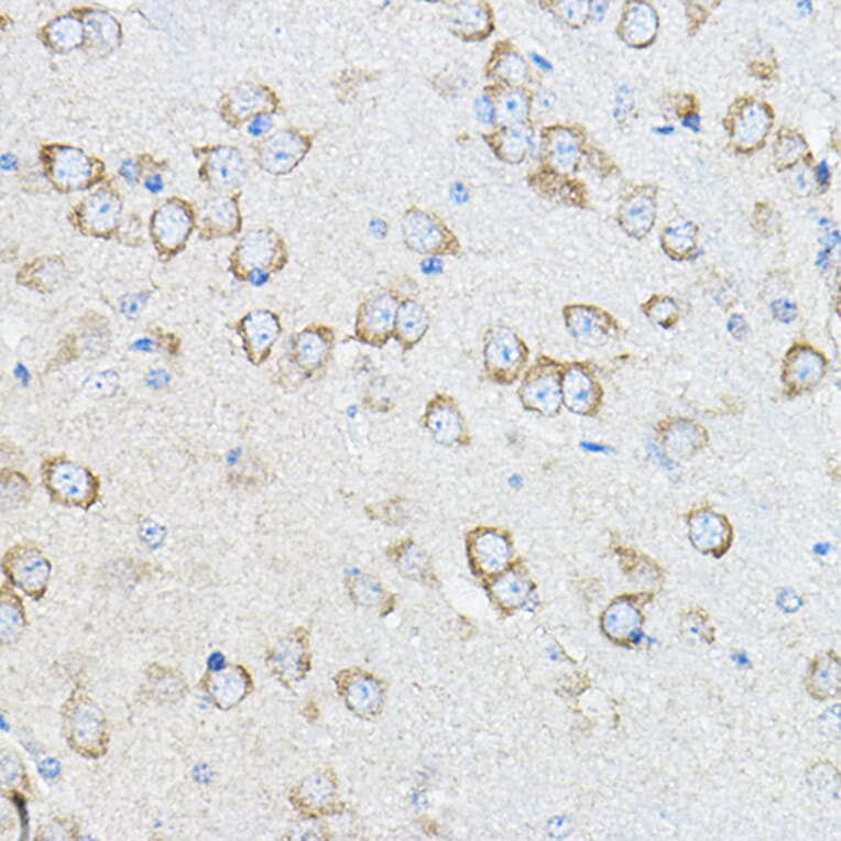 Immunohistochemistry - Anti-Stromal interaction molecule 1 Antibody (A309009) - Antibodies.com