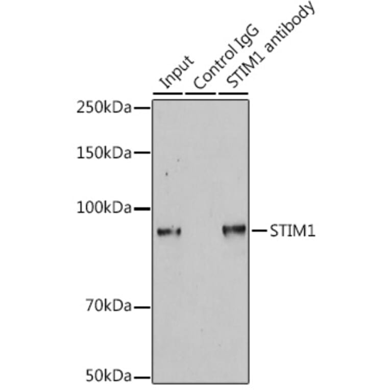 Western Blot - Anti-Stromal interaction molecule 1 Antibody (A309009) - Antibodies.com