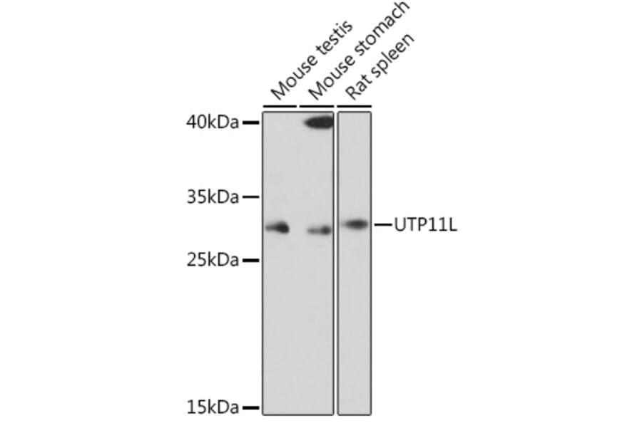 Western Blot - Anti-UTP11L Antibody (A309010) - Antibodies.com