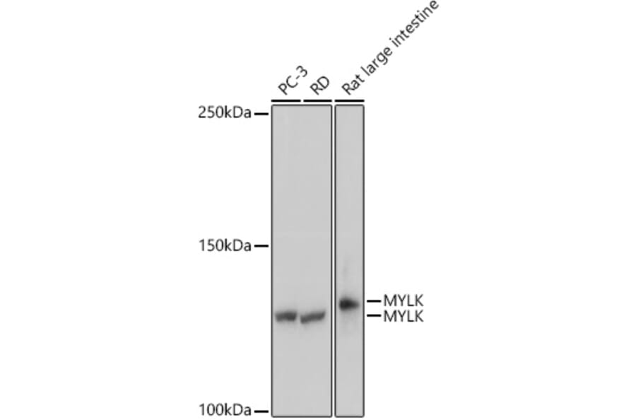 Western Blot - Anti-Myosin light chain kinase/MLCK Antibody [ARC0842] (A309011) - Antibodies.com