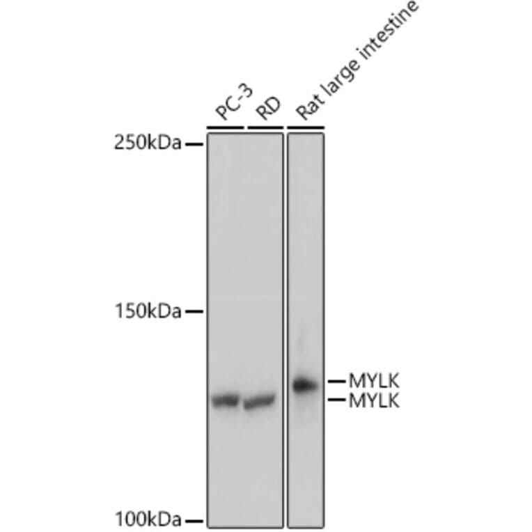 Western Blot - Anti-Myosin light chain kinase/MLCK Antibody [ARC0842] (A309011) - Antibodies.com