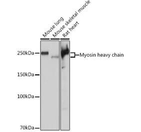Western Blot - Anti-Myosin heavy chain Antibody [ARC1170] (A309012) - Antibodies.com