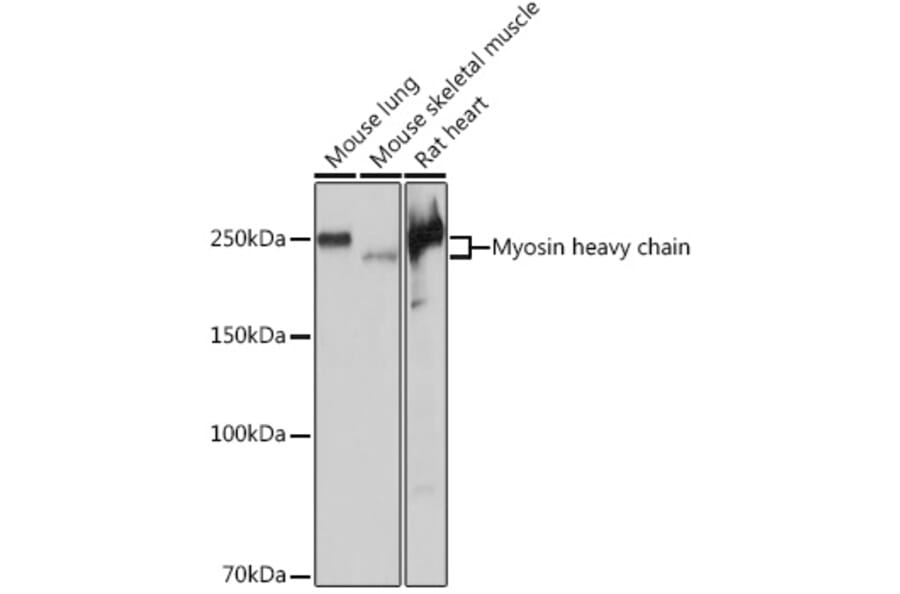 Western Blot - Anti-Myosin heavy chain Antibody [ARC1170] (A309012) - Antibodies.com