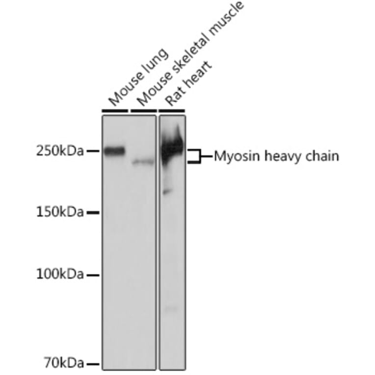 Western Blot - Anti-Myosin heavy chain Antibody [ARC1170] (A309012) - Antibodies.com