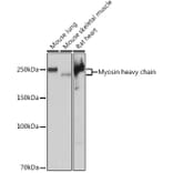 Western Blot - Anti-Myosin heavy chain Antibody [ARC1170] (A309012) - Antibodies.com