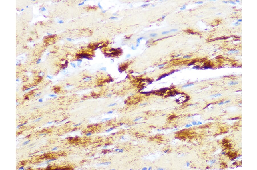Immunohistochemistry - Anti-Myosin heavy chain Antibody [ARC1170] (A309012) - Antibodies.com
