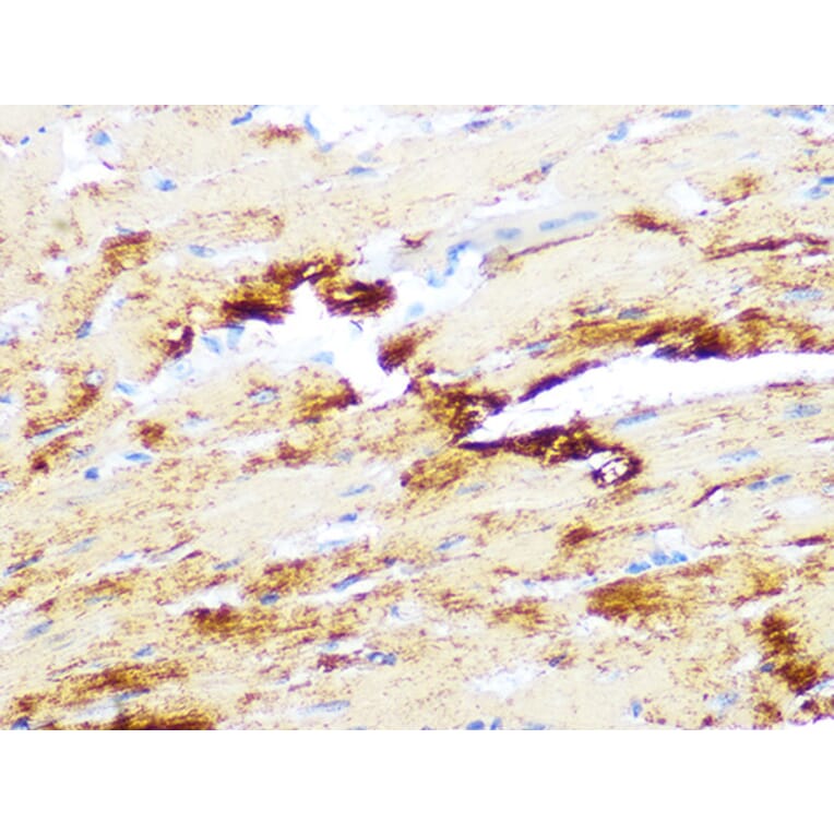 Immunohistochemistry - Anti-Myosin heavy chain Antibody [ARC1170] (A309012) - Antibodies.com
