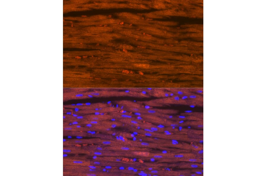 Immunofluorescence - Anti-Myosin heavy chain Antibody [ARC1170] (A309012) - Antibodies.com