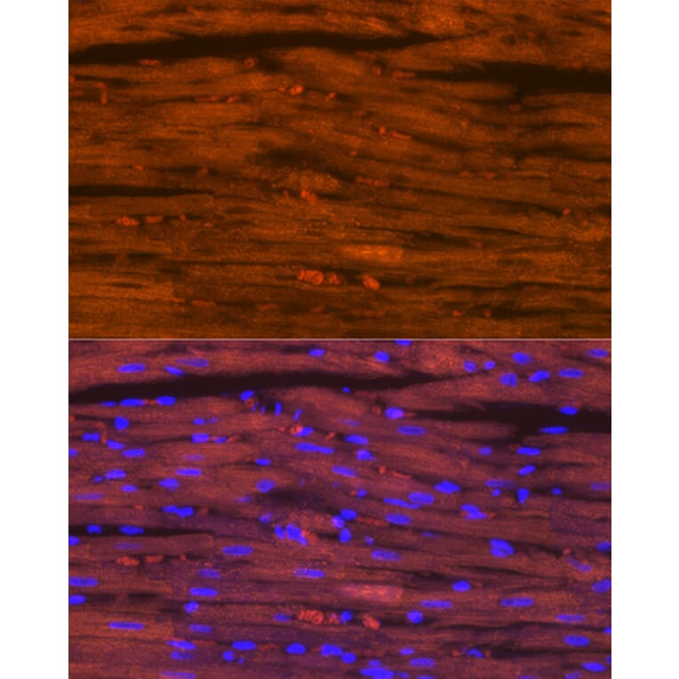 Immunofluorescence - Anti-Myosin heavy chain Antibody [ARC1170] (A309012) - Antibodies.com