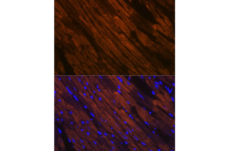 Immunofluorescence - Anti-Myosin heavy chain Antibody [ARC1170] (A309012) - Antibodies.com