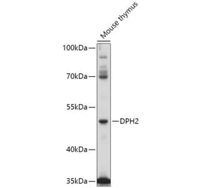 Western Blot - Anti-DPH2 Antibody (A309013) - Antibodies.com
