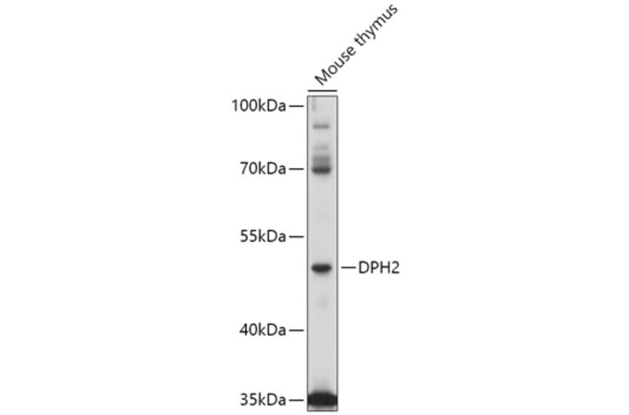 Western Blot - Anti-DPH2 Antibody (A309013) - Antibodies.com