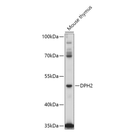 Western Blot - Anti-DPH2 Antibody (A309013) - Antibodies.com