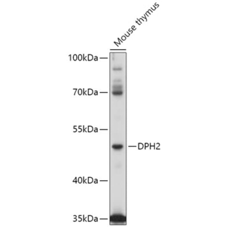 Western Blot - Anti-DPH2 Antibody (A309013) - Antibodies.com