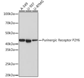 Western Blot - Anti-P2Y6 Antibody [ARC0831] (A309014) - Antibodies.com