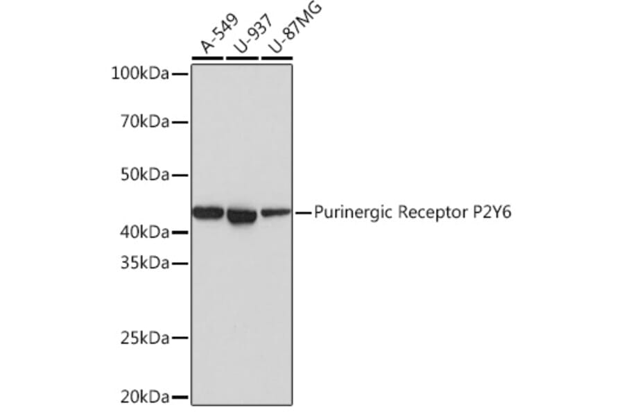 Western Blot - Anti-P2Y6 Antibody [ARC0831] (A309014) - Antibodies.com