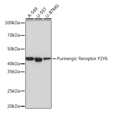 Western Blot - Anti-P2Y6 Antibody [ARC0831] (A309014) - Antibodies.com