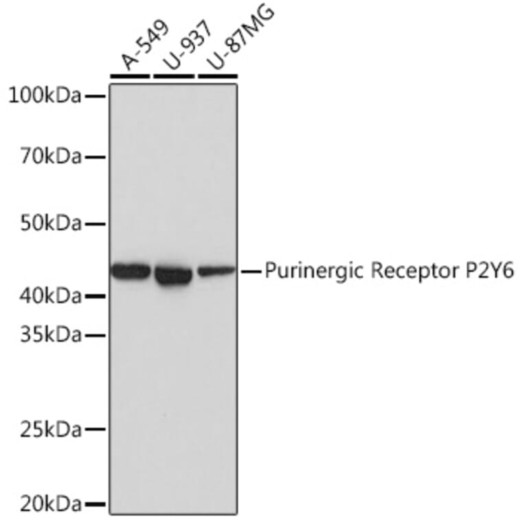 Western Blot - Anti-P2Y6 Antibody [ARC0831] (A309014) - Antibodies.com