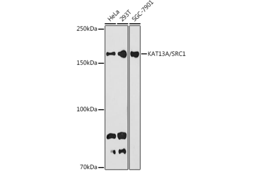 Western Blot - Anti-KAT13A/SRC1 Antibody [ARC1395] (A309015) - Antibodies.com
