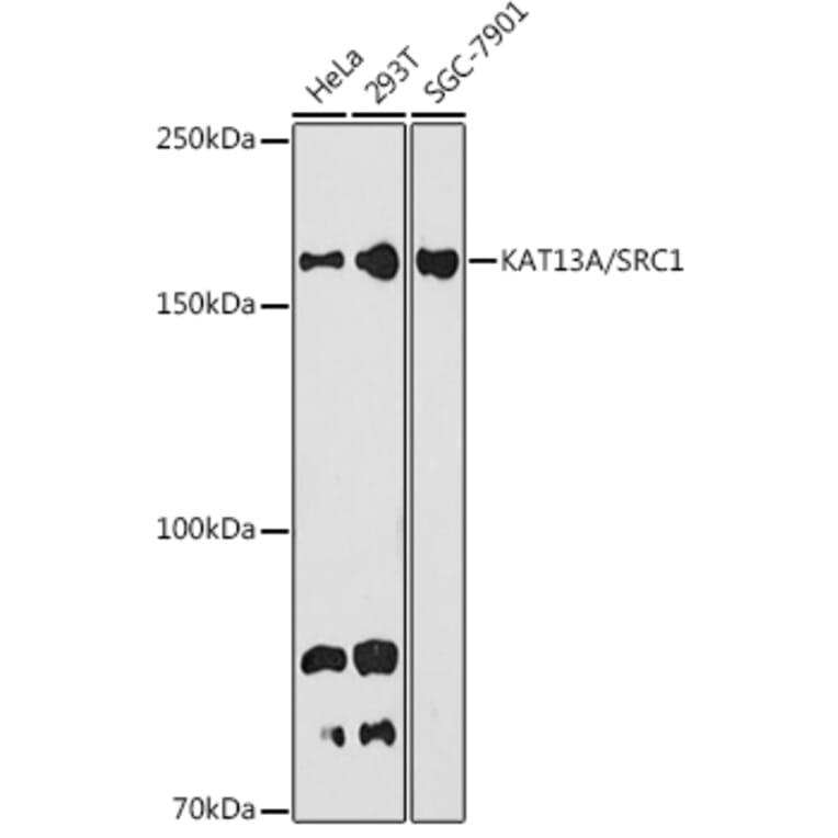 Western Blot - Anti-KAT13A/SRC1 Antibody [ARC1395] (A309015) - Antibodies.com