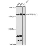 Western Blot - Anti-KAT13A/SRC1 Antibody [ARC1395] (A309015) - Antibodies.com