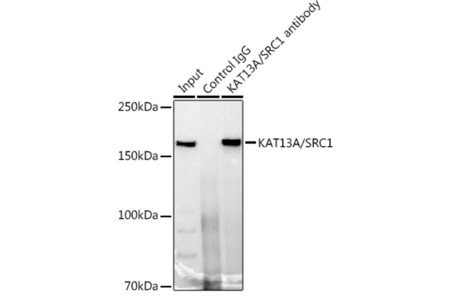 Western Blot - Anti-KAT13A/SRC1 Antibody [ARC1395] (A309015) - Antibodies.com
