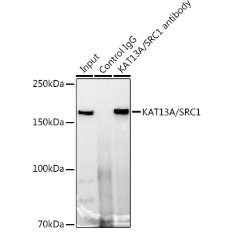 Western Blot - Anti-KAT13A/SRC1 Antibody [ARC1395] (A309015) - Antibodies.com