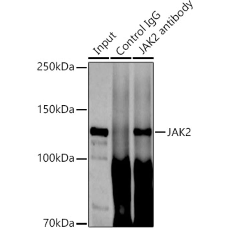 Western Blot - Anti-JAK2 Antibody [ARC0108] (A309016) - Antibodies.com