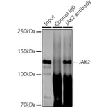 Western Blot - Anti-JAK2 Antibody [ARC0108] (A309016) - Antibodies.com