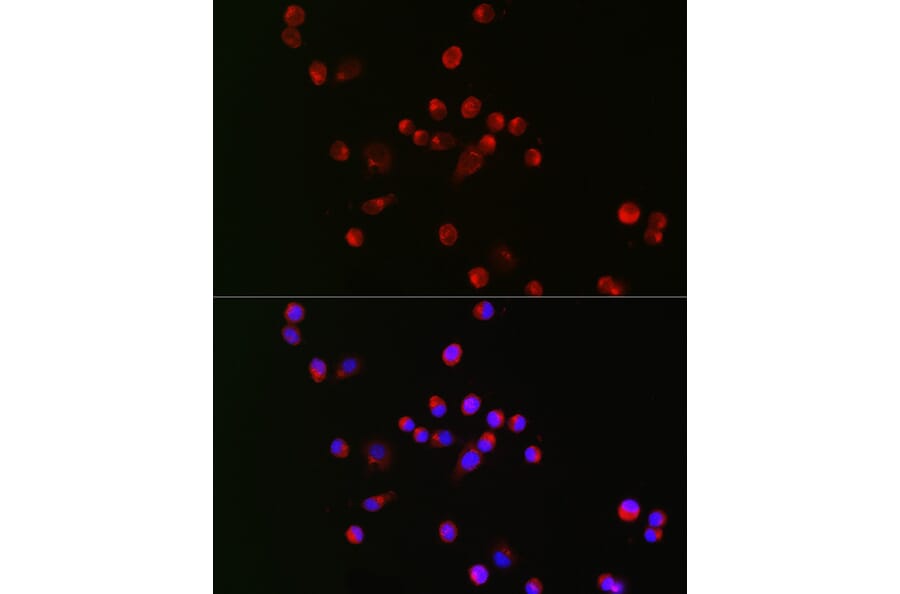 Immunofluorescence - Anti-Nav1.8 / SCN10A Antibody (A309017) - Antibodies.com