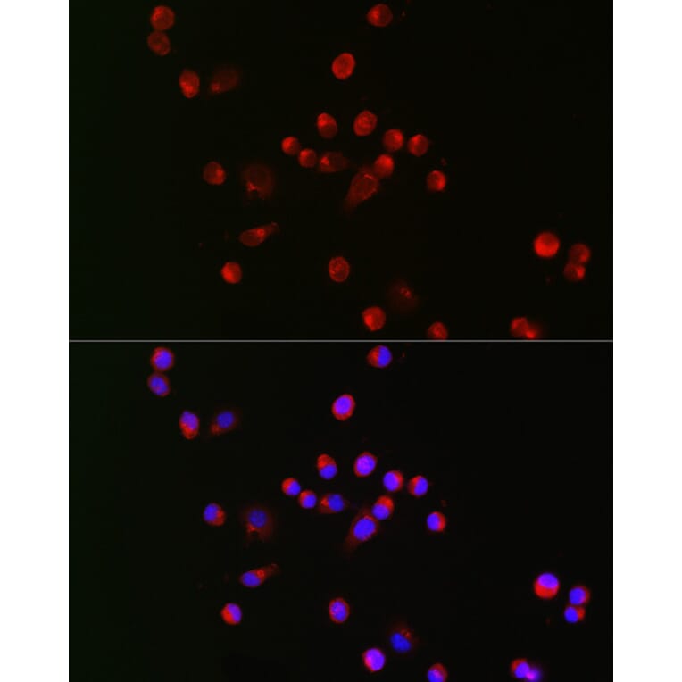 Immunofluorescence - Anti-Nav1.8 / SCN10A Antibody (A309017) - Antibodies.com